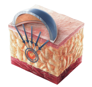 ilustracao-atuacao-sonofocus